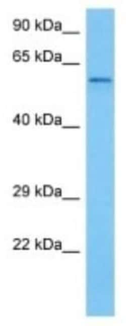 CYP2J5 Rabbit anti-Mouse, Polyclonal, Novus Biologicals 100 &mu;g | Buy Online | Novus Biologicals | Fisher Scientific